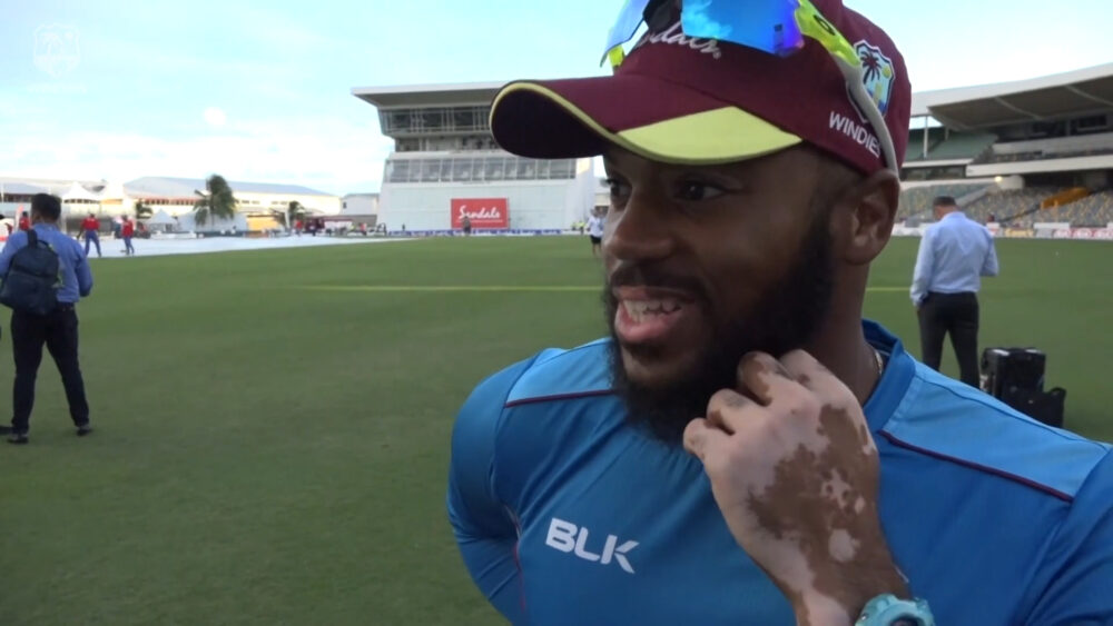 John campbell vitiligo disease